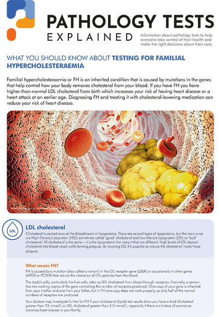 Familial hypercholesterolemia